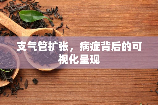 支气管扩张，病症背后的可视化呈现
