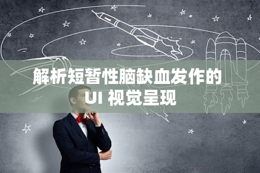 解析短暂性脑缺血发作的 UI 视觉呈现